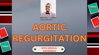 Aortic Regurgitation The essentials [upl. by Sisco]