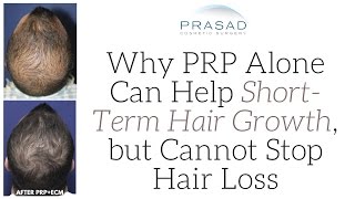 Why PRP Alone Can Help ShortTerm Hair Growth but Cannot Stop Hair Loss Progression [upl. by Arreit]