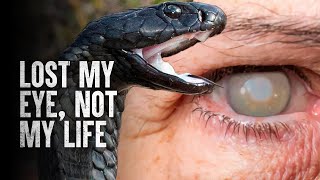 How to Survive a Spitting Cobra Attack [upl. by Nhguavahs]