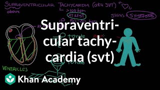 Supraventricular tachycardia SVT  Circulatory System and Disease  NCLEXRN  Khan Academy [upl. by Reube795]