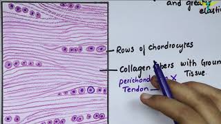 Histology Of Fibrocartilage [upl. by Gunnar516]