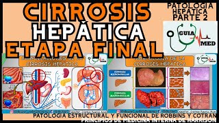 CIRROSIS HEPÁTICA ETAPA FINAL  GuiaMed [upl. by Elsinore]