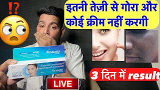 सबसे जल्दी गोरा करने वाली क्रीम सचाई  Ultrabrite skin cream  Ultrabrite skin cream kaise use kare [upl. by Amalbena]