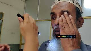 Cataract Examination  Eye Short Case  Cataract Examination Bangla Demonstration [upl. by Akimad]