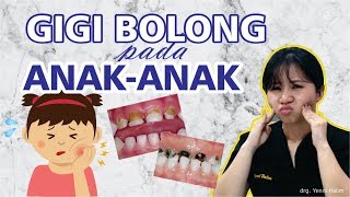 GIGI BOLONG PADA ANAKANAK [upl. by Pigeon684]