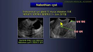소노엠 메디컬 아카데미 여성 생식기 초음파 5 강 [upl. by Tilly]