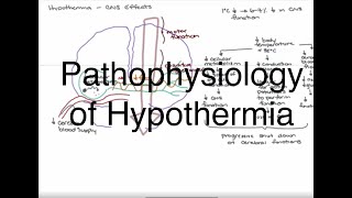 Hypothermia Pathophysiology [upl. by Nylynnej]