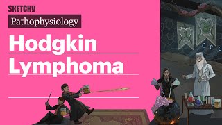 Hodgkin Lymphoma Pathophysiology  Sketchy Medical [upl. by Hance]