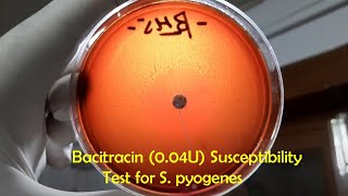 Bacitracin Sensitive Betahaemolytic Streptococci Streptococcus pyogenes [upl. by Alamap911]