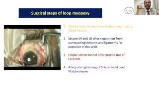 Lecture The Surgical Management of Myopic Strabismus Fixus [upl. by Ridgley]