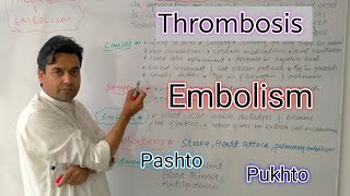 Thrombosis and Embolism  Biology class 11  Dr Mushtaq Pashto Lectures [upl. by Serafina]