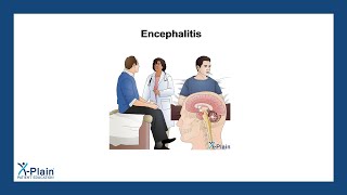 Encephalitis [upl. by Eelyahs]