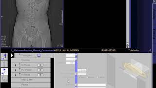 CT scan of urogram techniq [upl. by Okiruy]