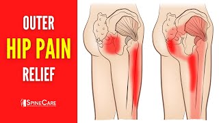 How to Fix Outer Hip Pain FOR GOOD [upl. by Ilse407]