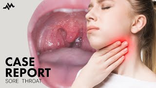 Sore throat and painful swallowing  Case Report [upl. by Mroz]