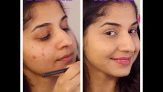 How to cover pimples  acne skin [upl. by Drusie]