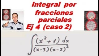 Integral por fracciones parciales Ej 4  caso 2 [upl. by Araminta]