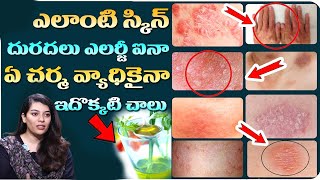 Skin Diseases Home Remedies in Telugu  Skin Allergy Oil  Charma  Dr Ravali  iDream Health [upl. by Hannaj]