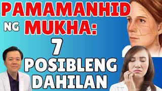 Pamamanhid ng Mukha 7 Posibleng Dahilan  By Doc Willie Ong Internist and Cardiologist [upl. by Cordier]