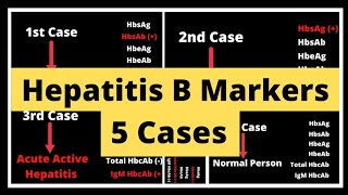 Hepatitis B Markers I Viral Markers Test I Diagnose Hepatitis B I HBV [upl. by Lexa]