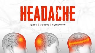 Headache  Types Causes Symptoms and Treatment Options  3D Guide [upl. by Aisinoid917]