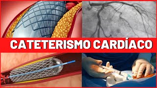 CATETERISMO CARDIACO e ANGIOPLASTIA  COMO É FEITO  RISCOS  INDICAÇÕES  O QUE VOCÊ TEM QUE SABER [upl. by Ynaffyt]