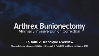 Minimally Invasive Bunion Surgery Technique Overview and Best Practices [upl. by Elwee356]