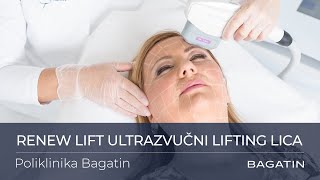 Renew Lift ultrazvučni lifting lica  Poliklinika Bagatin [upl. by Hanzelin]