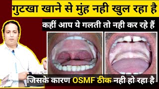 OSMF में ये गलती भुलकर भी नही करनी चाहिए ।। Submucous Fibrosis ।। Redused Mouth Opening osmf [upl. by Salomo]