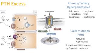 Hypercalcemia and Hypocalcemia [upl. by Ailimat]