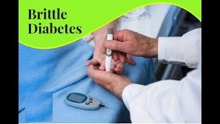 Brittle Diabetes Symptoms and Causes  Diagnosis  Treatment  Prevention disease healthcare [upl. by Absa]