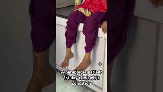 paraplegia patient paralysistreatment paralysis physiotherapytreatment shortsvideo shortsfeed [upl. by Ehcor]