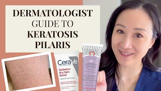 Dermatologist Guide to KP  Keratosis Pilaris Chicken Skin [upl. by Lahcym]