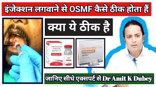 इंजेक्शन लगवाने से मुंह बंद कैसे ठीक होता हैं। OSMF treatment submucous fibrosis [upl. by Shannah]