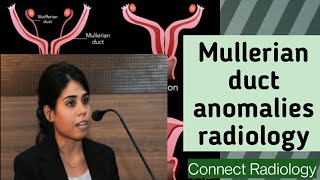 Mullerian duct anomalies radiology  PART1 [upl. by Aiciram274]