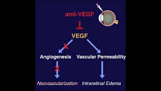 AntiVEGF for the treatment of Retinal Diseases  ANCHOR MARINA BRAVO CRUISE DRCR Protocol I [upl. by Sedda783]