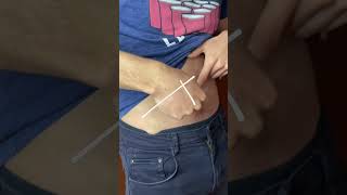 Como saber si alguien tiene apendicitis shorts aprende [upl. by Nus]