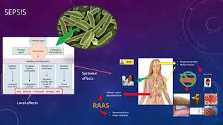 Tuesday Topic 003 The Key to Sepsis [upl. by Glinys962]