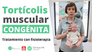 Tratamiento tortícolis muscular congénita 👶 Clínica H3 fisioterapia 2024 [upl. by Nosde222]