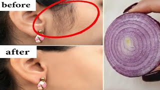 Stop shaving Heres how to get rid permanently facial body and pubic hair [upl. by Neelrahc]