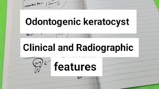 Odontogenic keratocyst Oral PATHOLOGY [upl. by Steele130]