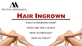 how to remove ingrown hair  كل ما تحتاجين معرفته عن نمو الشعر داخل الجلد [upl. by Urian]