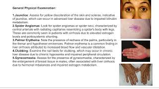 MRCP PACES CONSULTATION STATION HEPATOMEGALY WITH ASCITES [upl. by Ammamaria]