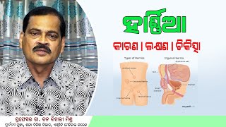 Hernia Causes Symptoms Treatment Advice Health Tips Doctor Tips SUSTTHA ODISHA [upl. by Aihsit]