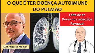 O que é ter doença autoimune do pulmão Fibrose pulmonar [upl. by Ojyram]