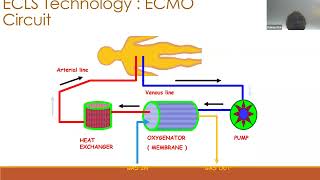 03 ECMO  Physiology by Dr Pranay Oza ECMO INDIA OCT 2024  Day 01 [upl. by Jaquith269]