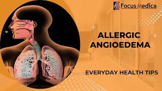 Allergic angioedemaSkin Allergy [upl. by Anette]