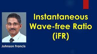 Instantaneous Wave free Ratio iFR [upl. by Drape]