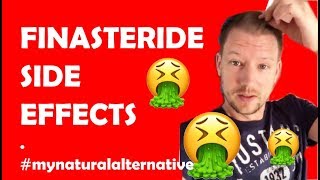 Finasteride Side Effects  my natural alternative [upl. by Justus54]