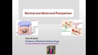 Normal and Abnormal Puerperium [upl. by Gora]